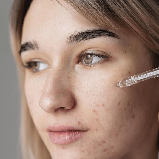 Organic Skin Spot Purifying Serum. Shop Skin Care on Mounteen. Worldwide shipping available.